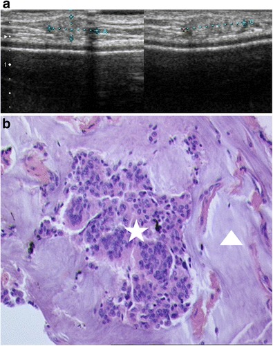 Fig. 15