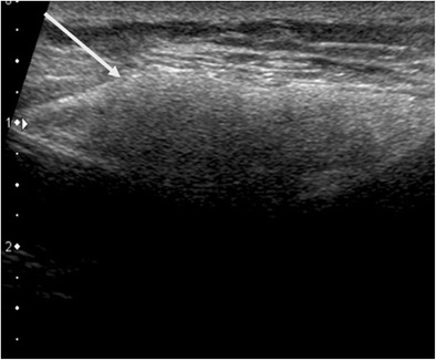 Fig. 11