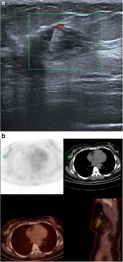 Fig. 19