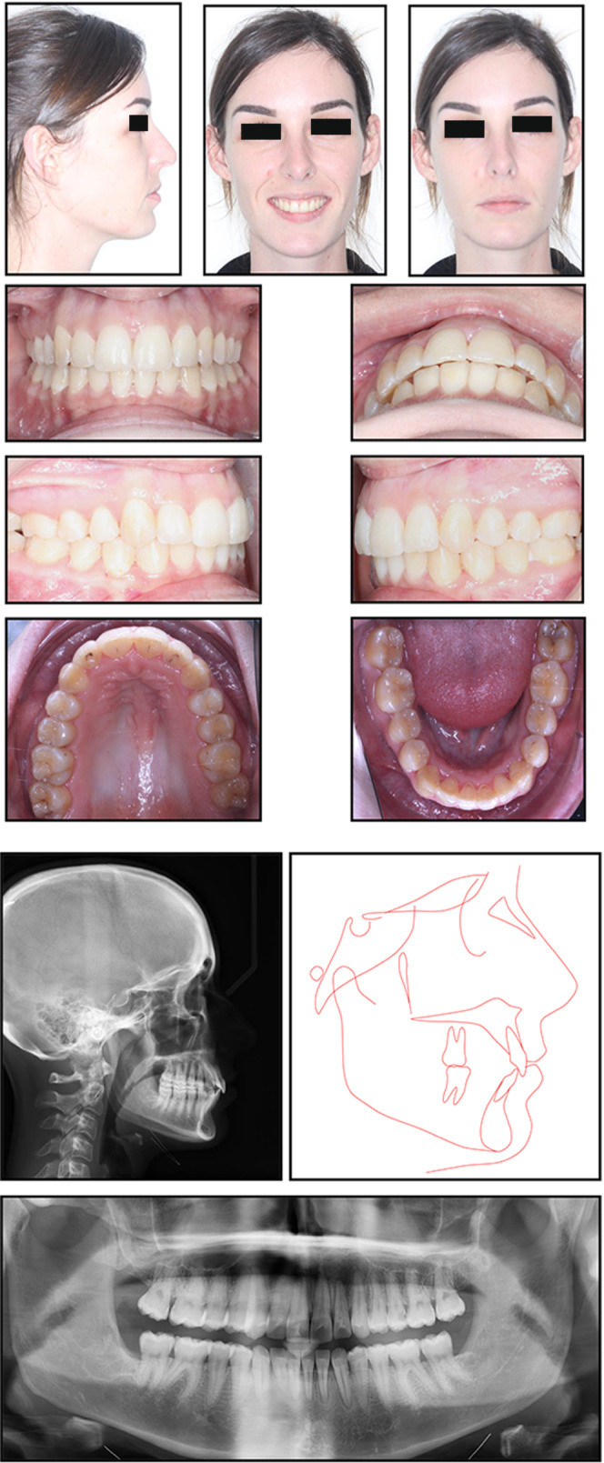 FIGURE 4