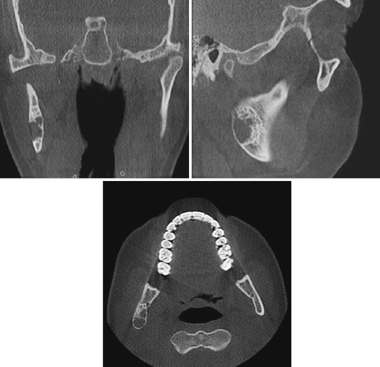 Fig. 2