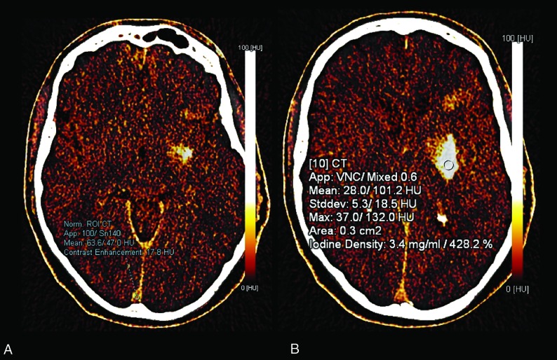 Fig 1.