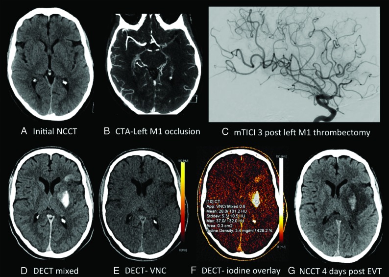 Fig 2.