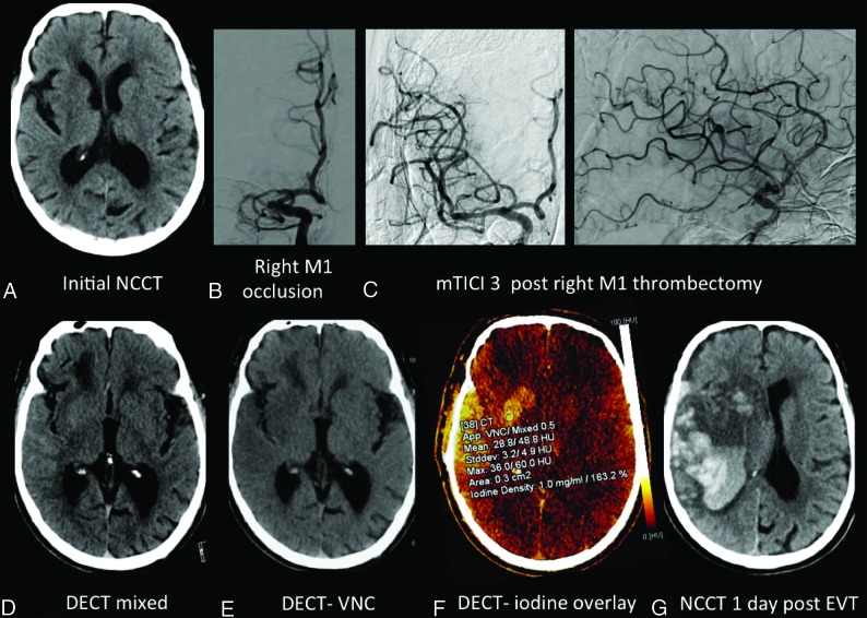 Fig 3.