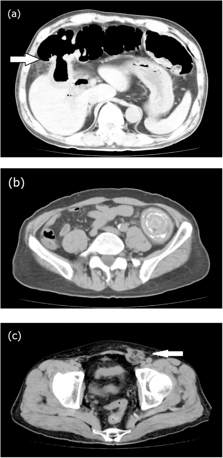 Fig. 2