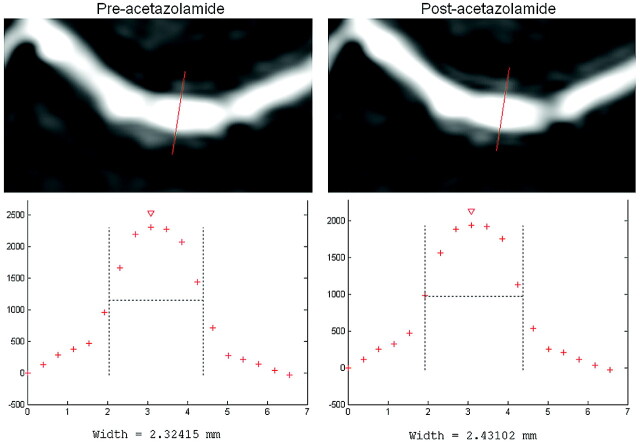 Fig 1.