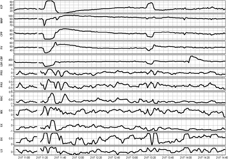 Fig. 1