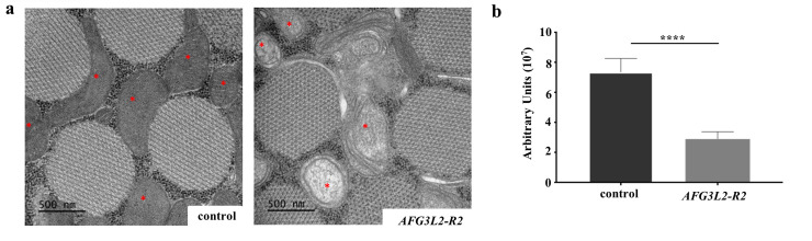 Inactivation of the mitochondrial protease Afg3l2 results in severely ...