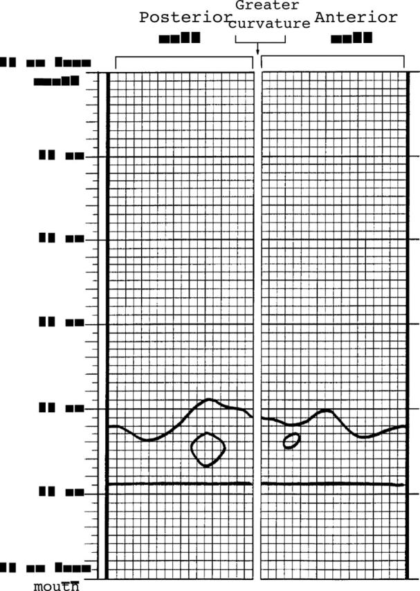 Figure 1  