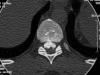 Figure 1A