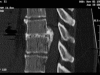 Figure 1B