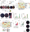 Figure 3. Multidimensional analysis of the NSCLC tumor ecosystem by IMC. A, Schematic representation of the IMC workflow on a formalin-fixed, paraffin-embedded tissue microarray. Key steps include staining with metal-tagged antibodies, spot-by-spot laser ablation, and acquisition by a mass cytometer. High dimensional images are reconstructed, processed, and segmented at both cellular and tissue level, generating data for further analyses. B, Heat map showing the mean values of key lineage markers adopted for cell cluster annotation. Proteins and cell phenotypes are ordered by hierarchical clustering with the Pearson correlation distance. Protein expression is color-coded from blue (lower) to red (higher) and scaled by column. C, Representative matched pictures of a NSCLC specimen showing pan-cytokeratin–positive tumor cells (left) and the tissue segmentation resulting from the machine learning pixel classifier (right). D, Spatial distribution and quantification of immune cell populations as the absolute cell number per mm2 (left) or as a percentage of total immune cells (right) in the tumor and the stroma. E, Heat map showing the normalized marker expression in each macrophage cluster. Markers and cell clusters are ordered by hierarchical clustering according to Pearson correlation distance. Mean values of marker expression are represented and color-coded from blue (lower) to red (higher) and scaled by column. Color code indicates cluster identity. F and G, UMAP projections of macrophage cells (n = 46733) from NSCLC tumors showing 20 clusters (F) or the cell distribution according to tissue segmentation (G). Each dot represents an individual cell. H, S100A8+ Mϕ infiltrate both the stroma and the tumor nests of NSCLC tissues. Representative pictures of the distribution of Mϕ (defined as CD68+ cells) and the subpopulation of S100A8+ Mϕ within tumor nests of a NSCLC tissue.