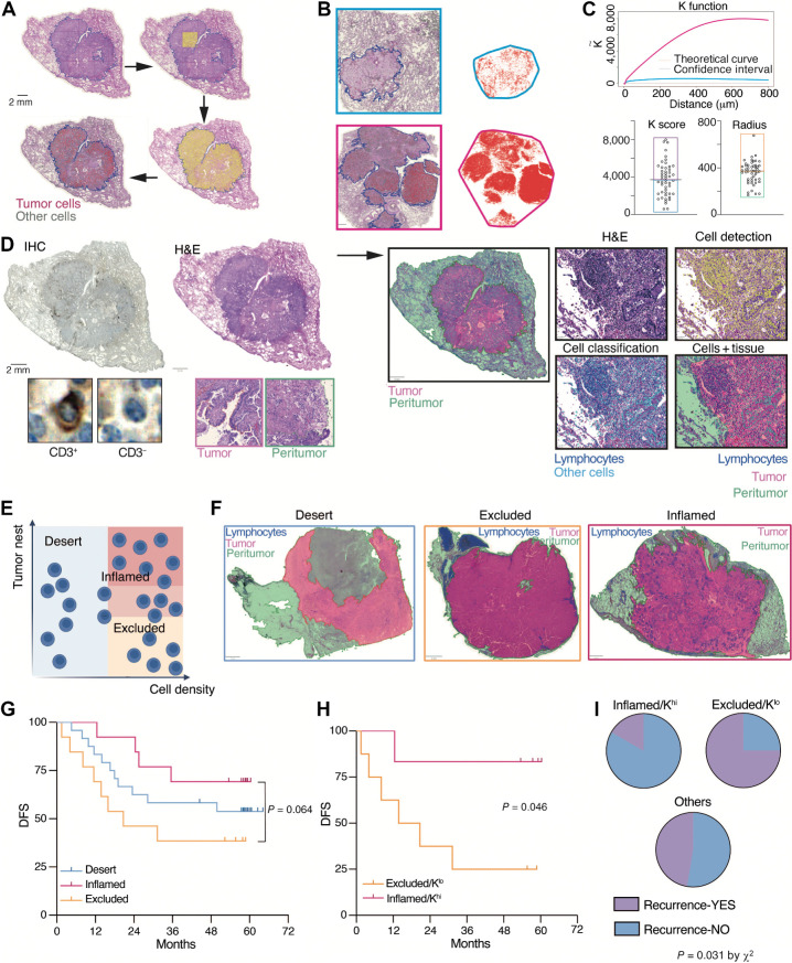 Figure 5. Deployment of the tumor and immune classifiers to the whole slide setting. A, Representative H&E images from one NSCLC specimen, showing the deployment of the tumor classifier to the WSI setting. From top left to bottom right, manual annotation of the tumor region, division in tiles, cell annotation, and cell classification. Scale bars, 2 mm. B, Two representative NSCLC WSIs, where tumor cells (red) are uniformly distributed (top) or highly clustered (bottom). Panels on the right show the relative point pattern distribution of cell centers used for the analysis with the Ripley's K function. C, Graph representing the normalized and centered Ripley's K function curves of the point pattern distribution of tumor cells from images shown in B (top). Distribution of tumor cell K score and cluster's radius indexes in n = 50 NSCLC specimens. Boxes indicate the cutoff used to classify the samples. Each dot represents one WSI from cohort 2. D, Schematic representation of the digital approach used to develop an immune classifier on WSIs. From left to right, CD3+ cell annotation, tissue segmentation, and combination. E, Classification of samples into desert, excluded, or inflamed, based on the cell density and tissue localization. F, Representative images of three NSCLC specimens classified as desert, excluded, or inflamed. Scale bar, 2 mm. G, Kaplan–Meier curve showing DFS of n = 50 patients classified as desert (n = 24), excluded (n = 13), or inflamed (n = 13). P = 0.064 by log-rank Mantel–Cox (inflamed vs. excluded). H, Kaplan–Meier curve showing DFS of patients classified as excluded/Klo (n = 8) or inflamed/Khi (n = 6). P = 0.046 by log-rank Mantel–Cox. I, Pie charts showing proportions of clinical outcomes (recurrence YES or NO) in the inflamed/Khi patients versus the excluded/Klo and others (P = 0.031 inflamed/Khi vs. excluded/Klo by χ2 test).
