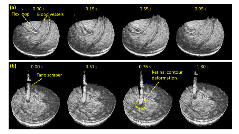 Fig. 11