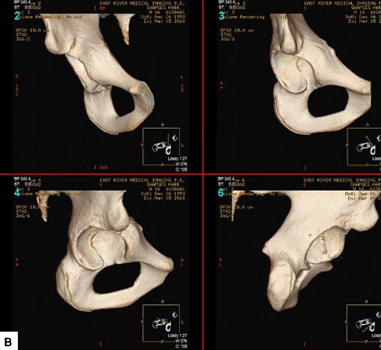 Fig. 5A–B