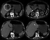 Fig. 11