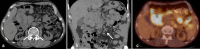 Fig. 19