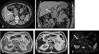 Fig. 13