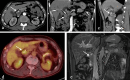Fig. 17
