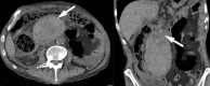 Fig. 12