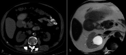 Fig. 15