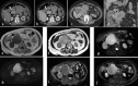 Fig. 16