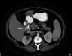 Fig. 14