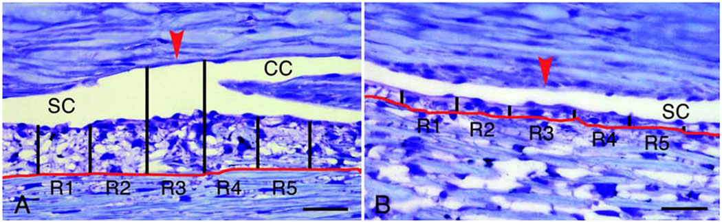 Figure 14.