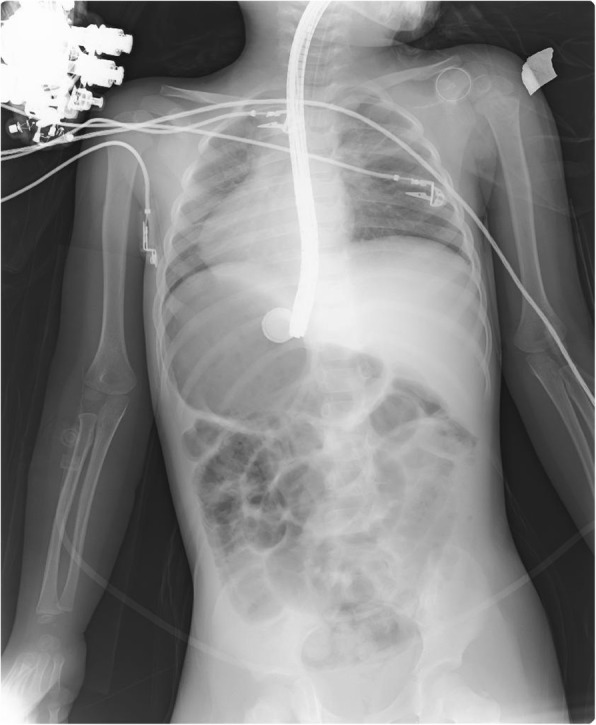 Fig. 1