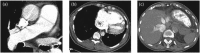 Fig 2.