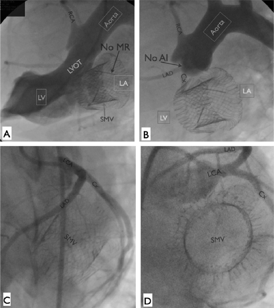 Fig 4