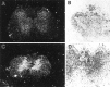 Fig. 11.