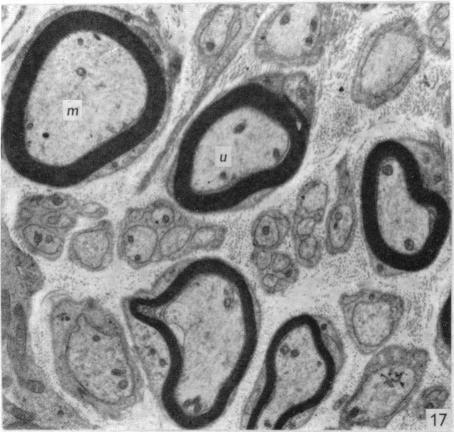 Fig. 17