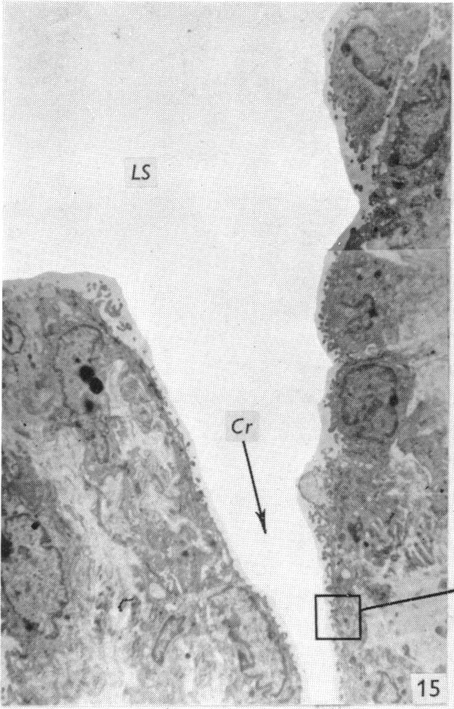 Fig. 15