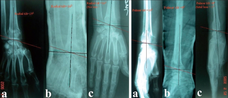 Figure 1A