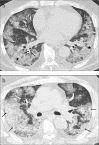 Figure 4. a, b