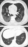 Figure 2. a, b