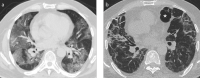 Figure 8. a, b