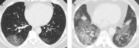 Figure 10. a, b