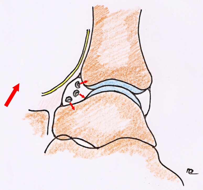 Fig. 4