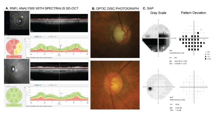 Fig. (1)