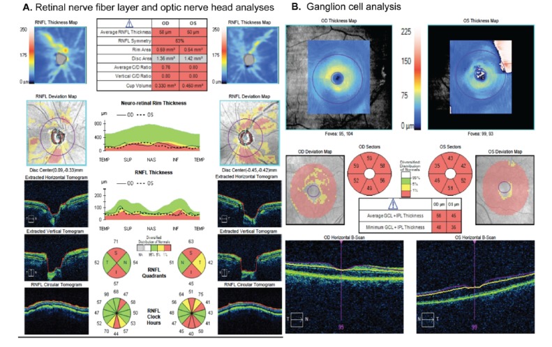 Fig. (2)