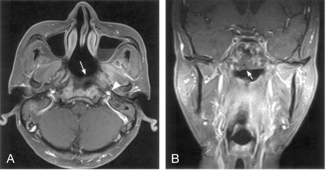 Fig 2.