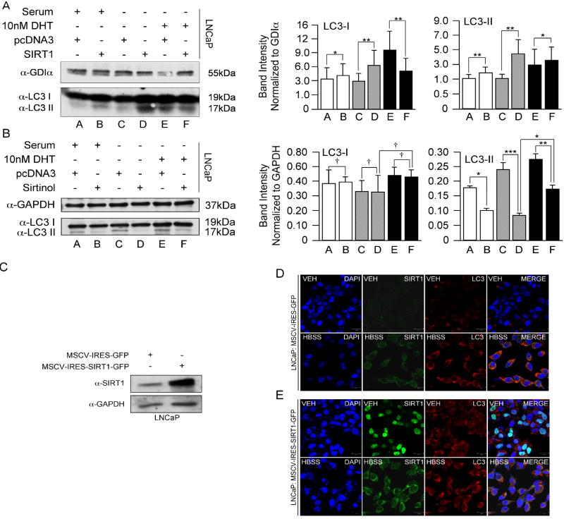 Disruption of a Sirt1 Dependent Autophagy Checkpoint in the Prostate ...