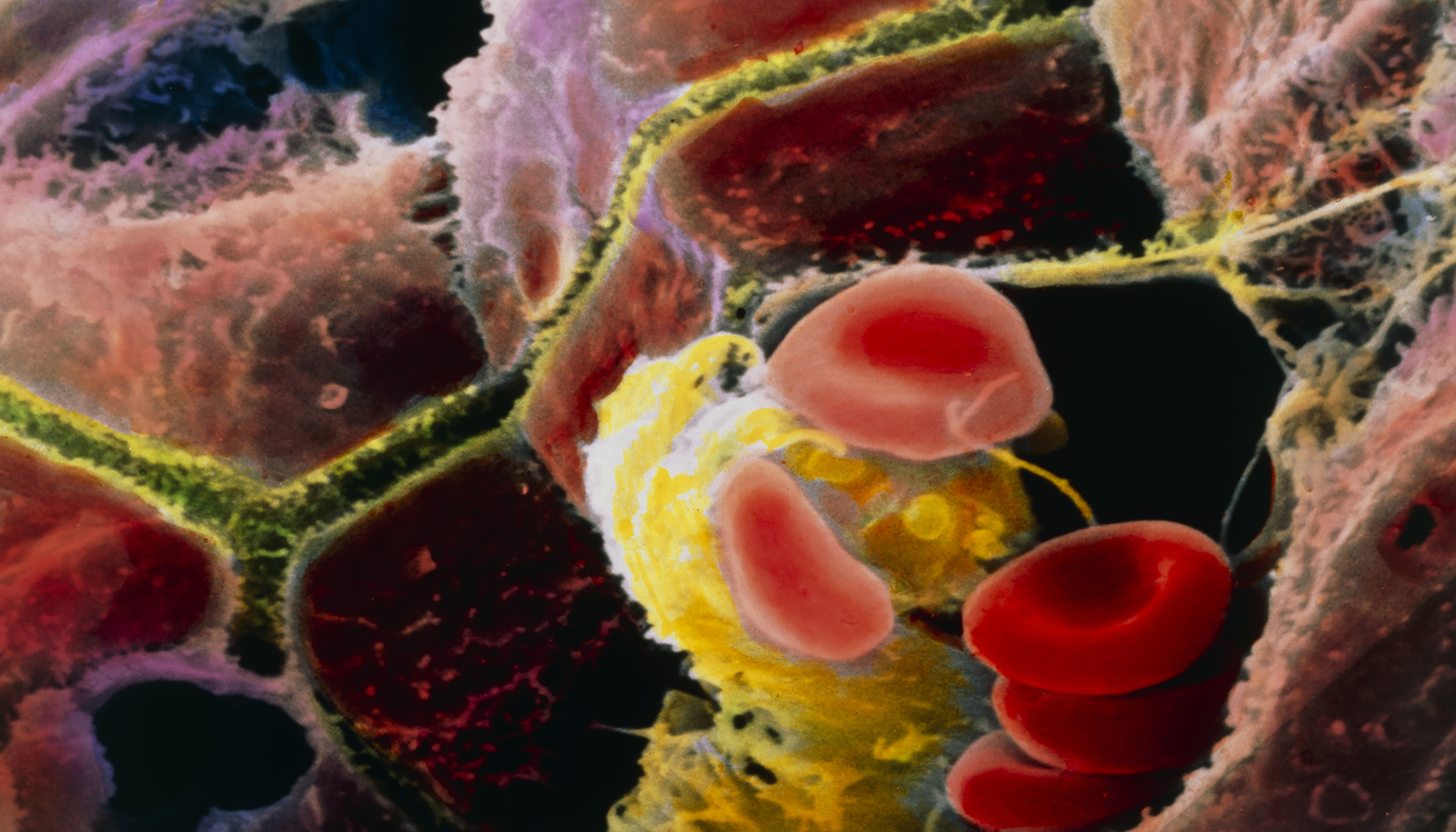 Scanning electron micrograph of hepatocytes, a macrophage, and red blood cells