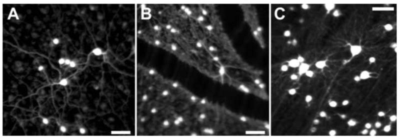 Fig. 15