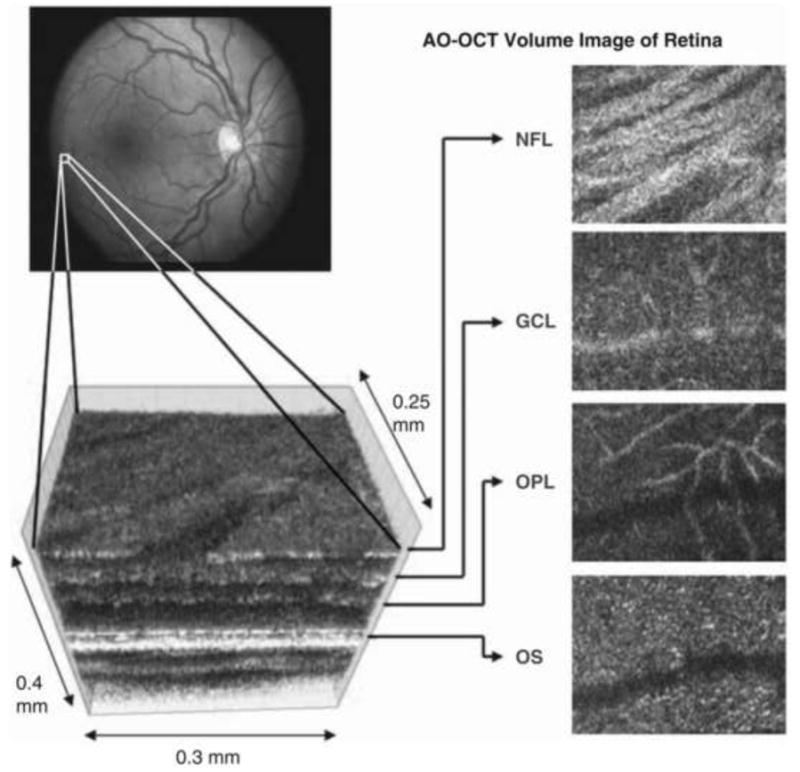 Fig. 16