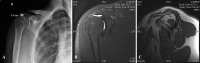 Fig. 1A–C