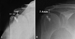 Fig. 5A–B