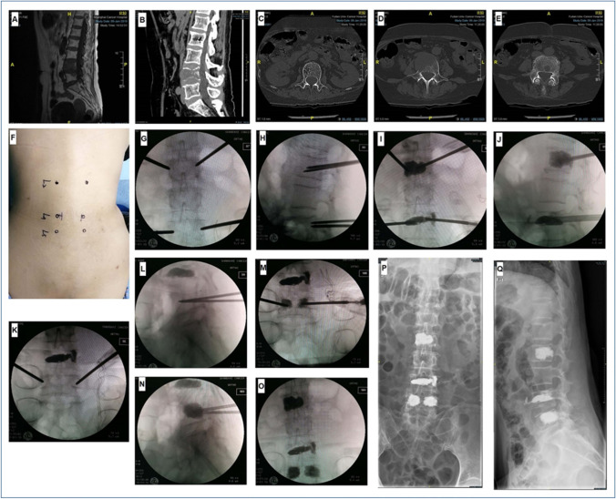 Fig. 5